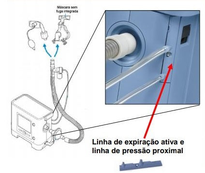 Circuito Pedriátrico Ativo Descartável para Ventilador Mecânico Trilogy - Philips Respironics