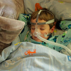 Máscara nasal Respireo Soft Child - CPAPS