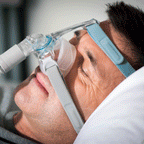 Máscara nasal Eson 2 - Fisher & Paykel - CPAPS